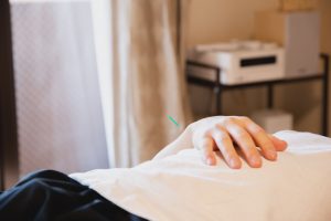 acupuncture
